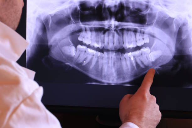 Best Walk-In Emergency Dentist in Kerens, TX