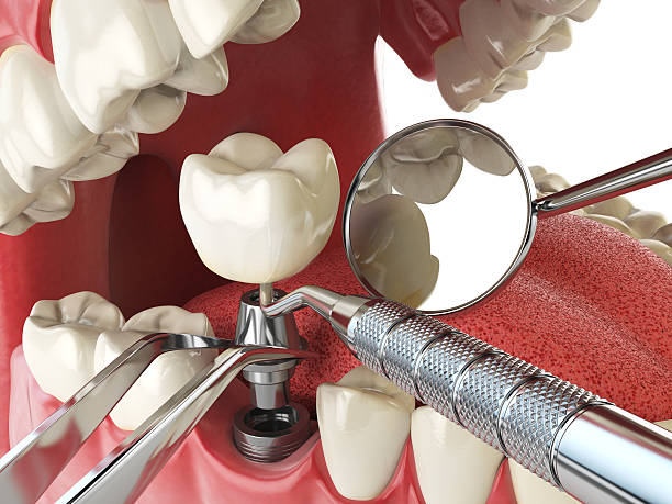 Best Urgent Dental Care in Kerens, TX